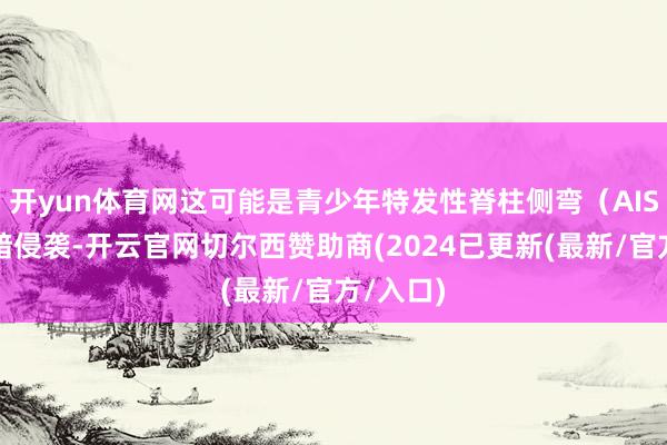 开yun体育网这可能是青少年特发性脊柱侧弯（AIS）在暗暗侵袭-开云官网切尔西赞助商(2024已更新(最新/官方/入口)